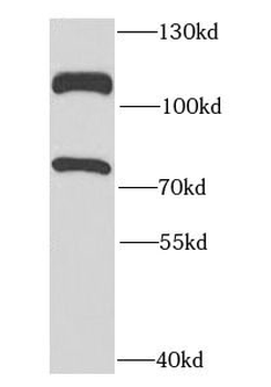 DDX20 Antibody