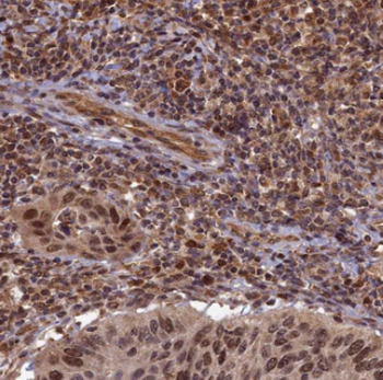 DDX3X Rabbit Polyclonal Antibody