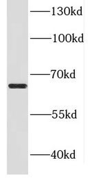 DDX52 Antibody