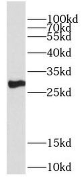 DECR2 Antibody