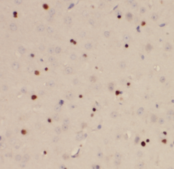 DEDD2 Rabbit Polyclonal Antibody