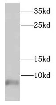 DEFA1 Rabbit Polyclonal Antibody