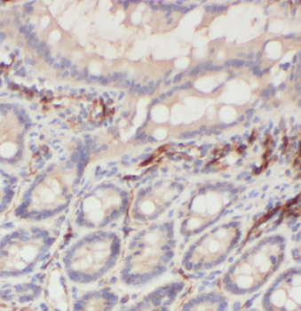 DEFA1 Rabbit Polyclonal Antibody