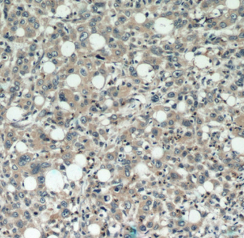 DEFB121 Antibody