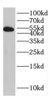DES Rabbit Polyclonal Antibody