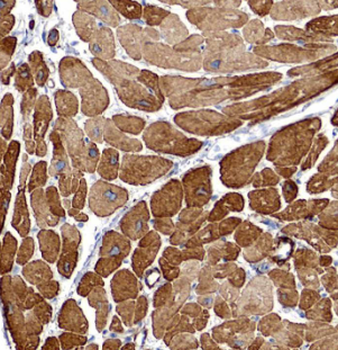 DES Rabbit Polyclonal Antibody