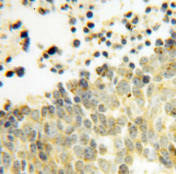 DEXI Antibody