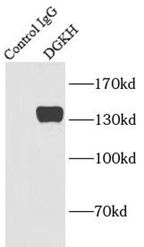 DGKH Antibody
