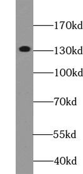 DGKH Rabbit Polyclonal Antibody