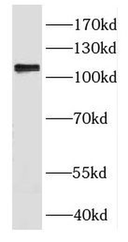 DGKQ Rabbit Polyclonal Antibody