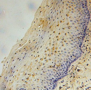 DGKQ Rabbit Polyclonal Antibody