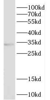 DHDDS Antibody