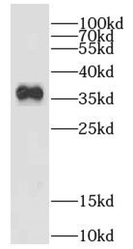 DHRS1 Antibody