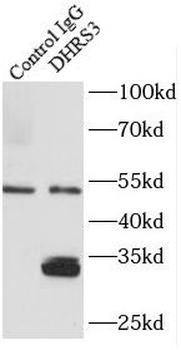 DHRS3 Antibody