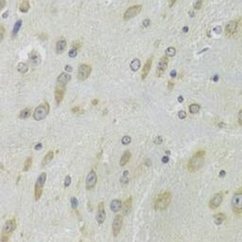 DHRS9 Rabbit Polyclonal Antibody