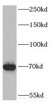 DHX35 Antibody