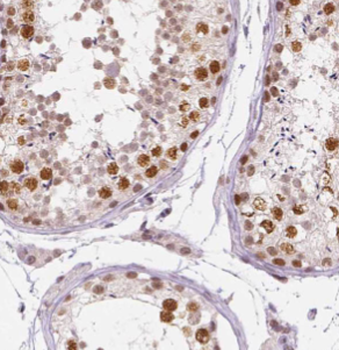 DHX35 Rabbit Polyclonal Antibody