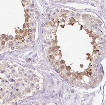 DHX57 Rabbit Polyclonal Antibody