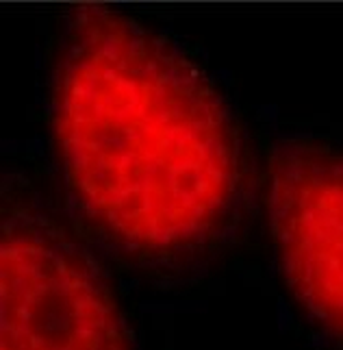 DHX9 Rabbit Polyclonal Antibody