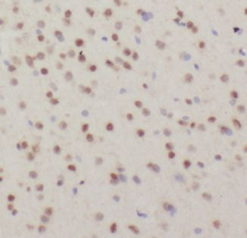 DHX9 Rabbit Polyclonal Antibody
