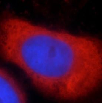 DICER1 Antibody