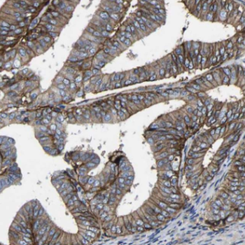DIO1 Rabbit Polyclonal Antibody
