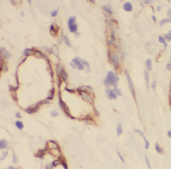DIRAS1 Rabbit Polyclonal Antibody