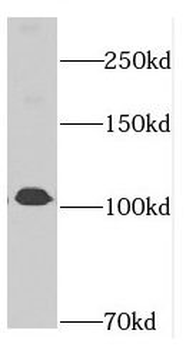 DIS3 Rabbit Polyclonal Antibody