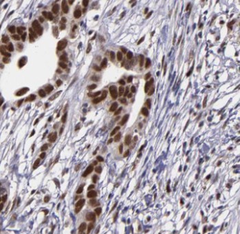 DIS3 Rabbit Polyclonal Antibody