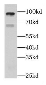 DIS3L2 Antibody