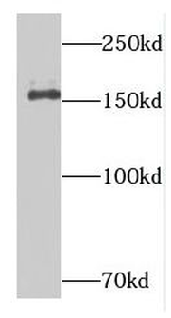 DISP1 Antibody