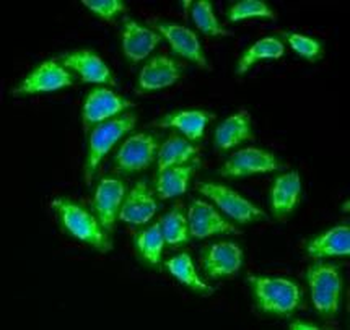DLAT Antibody