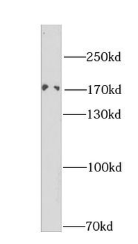 DLC1 Rabbit Polyclonal Antibody