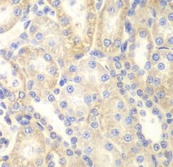 DLC1 Rabbit Polyclonal Antibody