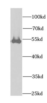 DLD Antibody