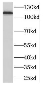 DLGAP3 Antibody