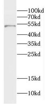 DMKN Rabbit Polyclonal Antibody