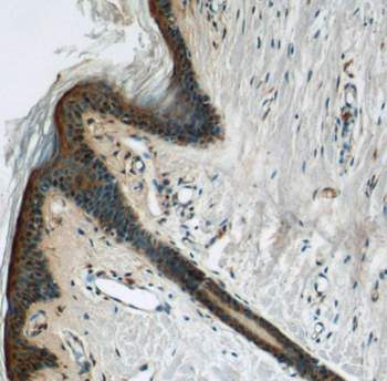 DMKN Rabbit Polyclonal Antibody