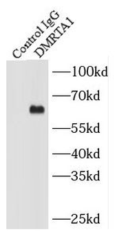 DMRTA1 Antibody
