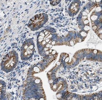 DNAH6 Antibody