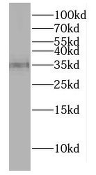 DNAJB13 Antibody