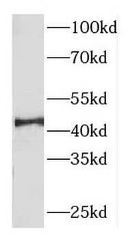 DNAJB14 Rabbit Polyclonal Antibody