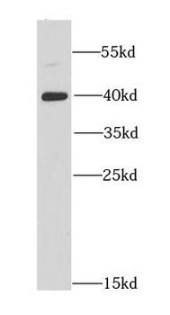 DNAJB6 Antibody