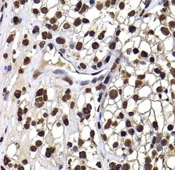 DNAJB6 Rabbit Polyclonal Antibody