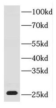 DNAJB8 Antibody