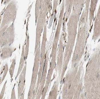 DNAJC11 Rabbit Polyclonal Antibody