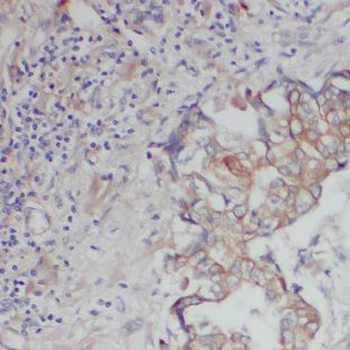 DNAJC4 Rabbit Polyclonal Antibody