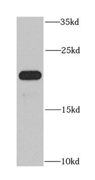 DNAL1 Antibody
