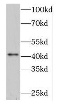 DNASE2B Antibody