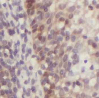 DNASE2B Rabbit Polyclonal Antibody